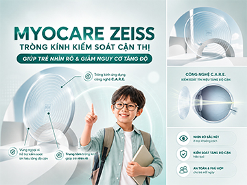 Kiểm Soát Cận Thị Trẻ Em: Stellest vs MiYOSMART vs MyoCare