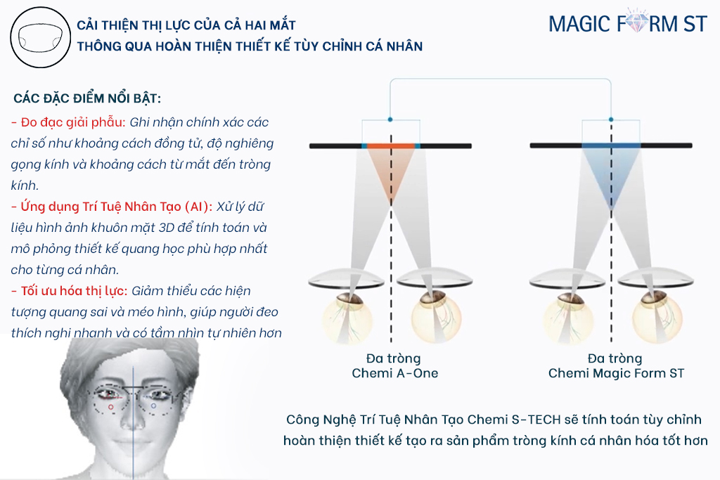TRÒNG KÍNH ĐA TRÒNG CHEMI RX MAGIC FORM ST - Hình 6